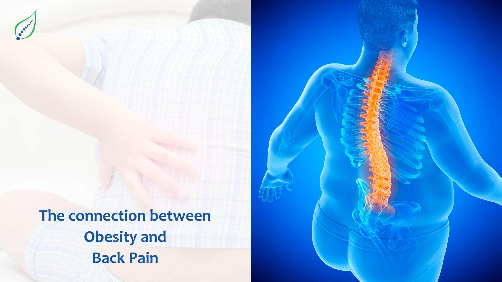 The Connection Between Obesity and Back Pain